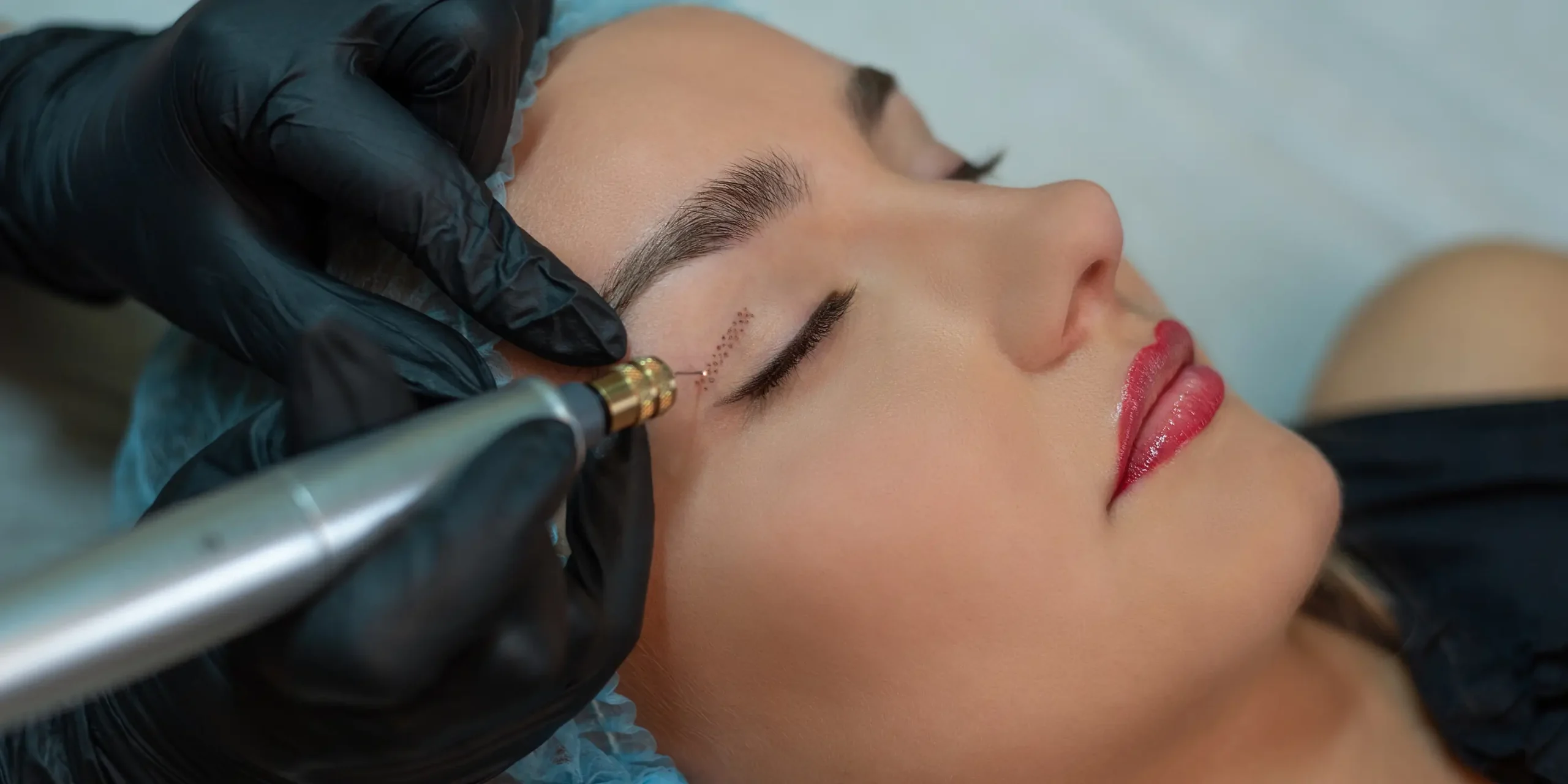 Laser or ultrasound facial therapy for skin tightening