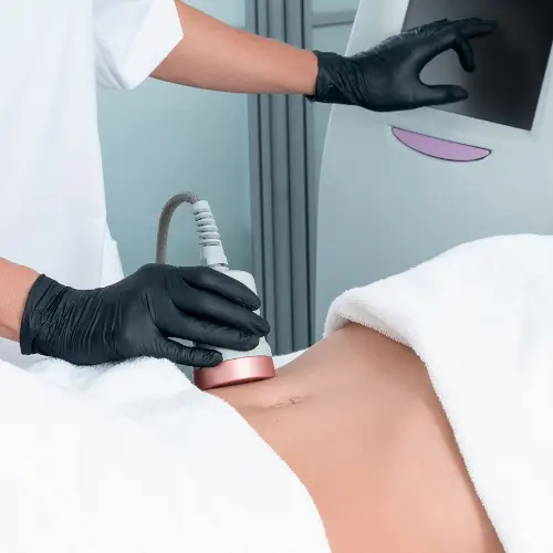 Body sculpting procedure using advanced device