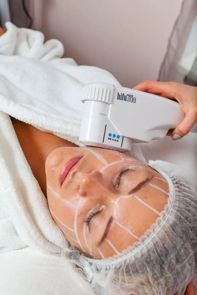 HIFU facial rejuvenation treatment to boost collagen and tighten skin