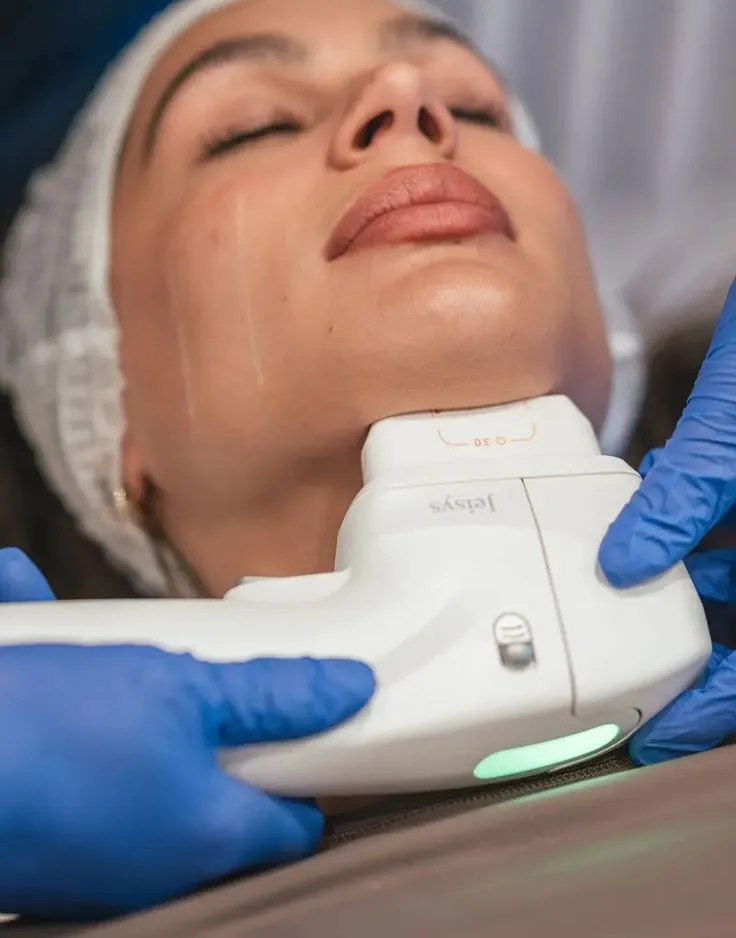 HIFU treatment targeting jawline to improve definition and firmness