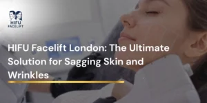 HIFU Facelift London: The Ultimate Solution for Sagging Skin and Wrinkles