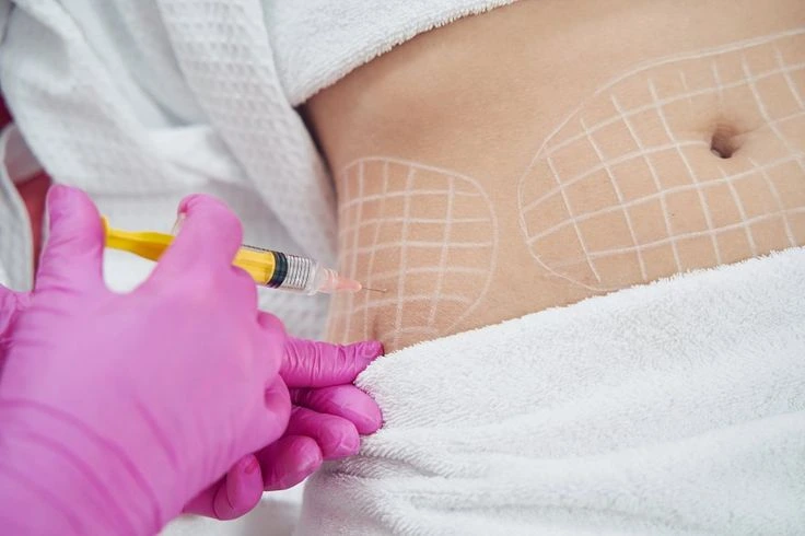 fat dissolving injections treatment UK