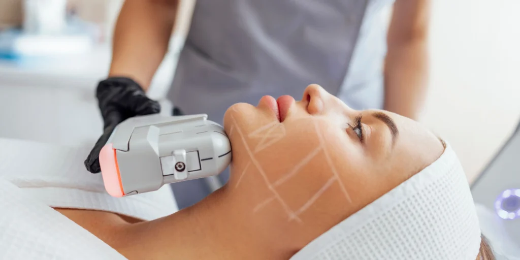 Non-invasive HIFU facelift procedure being performed in London for natural skin tightening