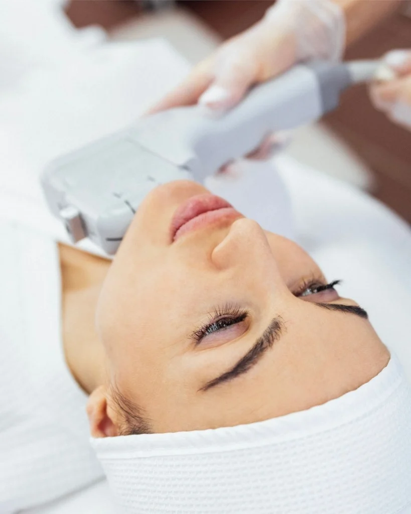 Non-surgical HIFU face lifting procedure for sagging skin