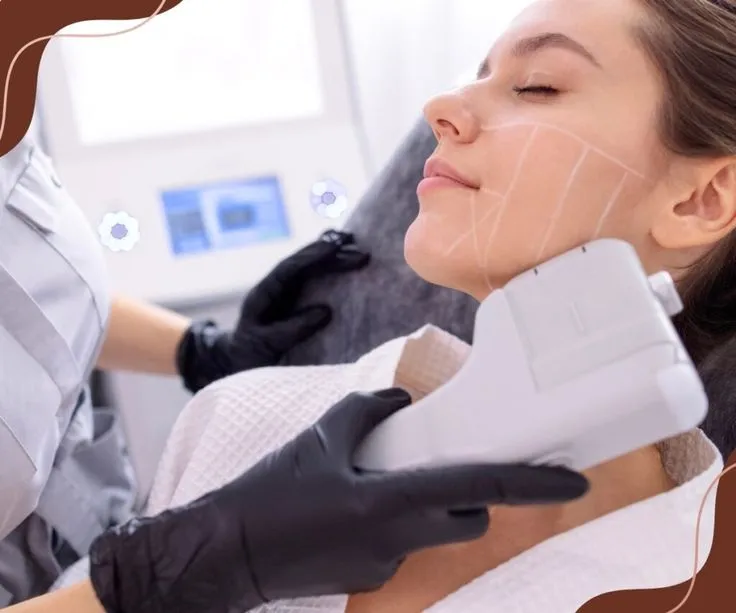 HIFU treatment in progress targeting deeper skin layers