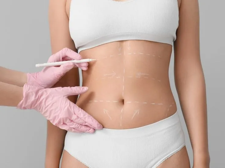 Fat reduction treatment targeting stubborn abdominal fat