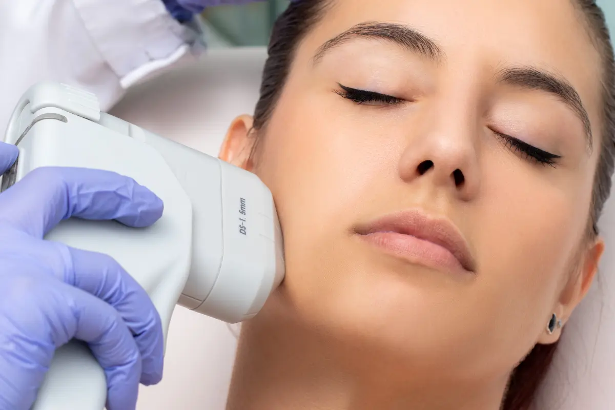 HIFU facelift treatment targeting the jawline for non-surgical skin tightening