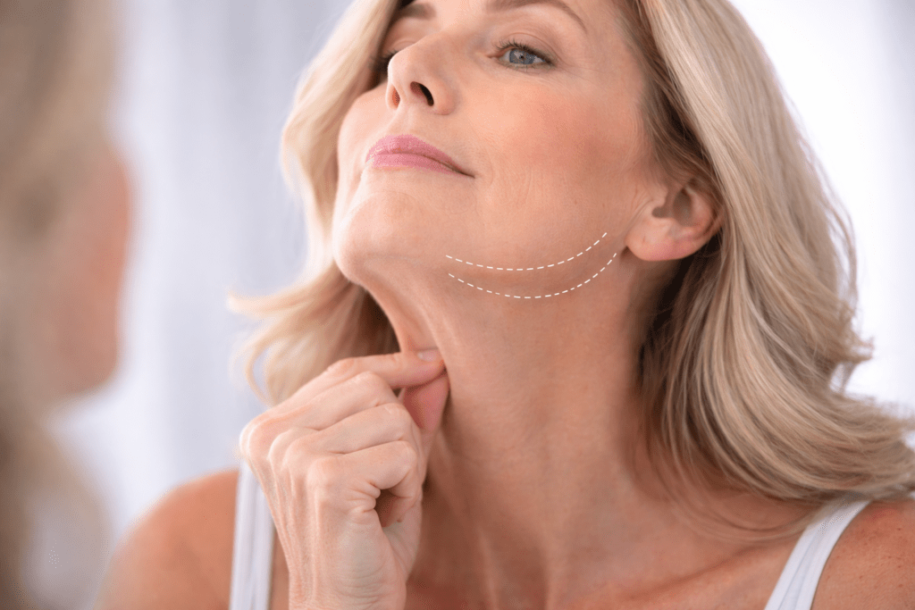 Skin laxity under the chin and jawline caused by natural ageing